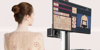 Dermatoscopie digitala cu sistem FotoFinder